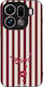Sonique Stripe Stories Series Oppo Find X9 Pro ...