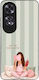 Sonique Stripe Stories Series Oppo A60 Case
