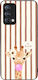 Θήκη Sonique Stripe Stories Series Series Realm...