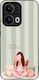 Sonique Case Stripe Stories Series Oppo Reno13 ...