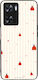 Sonique Stripe Stories Series Case OnePlus Nord...
