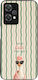 Sonique Stripe Stories Series Case OnePlus Nord...