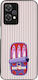 Sonique Stripe Stories Series Case OnePlus Nord...