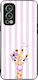 Sonique Stripe Stories Series OnePlus Nord 2 5G...