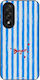 Калъф Sonique Stripe Stories Series Oneplus Nor...
