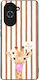Sonique Stripe Stories Series Huawei Nova 10 Br...