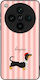 Sonique Stripe Stories Series Oppo Find X8 Pro ...