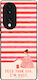 Калъф Sonique Stripe Stories Series Honor 70 5g...