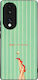 Калъф Sonique Stripe Stories Series Honor 70 5g...