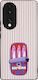 Sonique Stripe Stories Series Honor 70 5G Sardi...