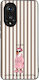Калъф Sonique Stripe Stories Series Honor 50 5G...