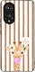 Калъф Sonique Stripe Stories Series Honor 50 5g...