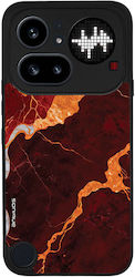 Θήκη Sonique Marble Series Nothing Phone 4a Pro...